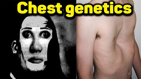 chest insertions genetics|types of chest genetics.